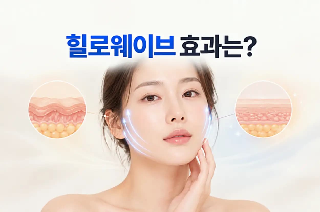 힐로웨이브 스킨부스터의 피부 탄력 및 리프팅 효과를 표현한 얼굴 윤곽과 피부층 변화 인포그래픽